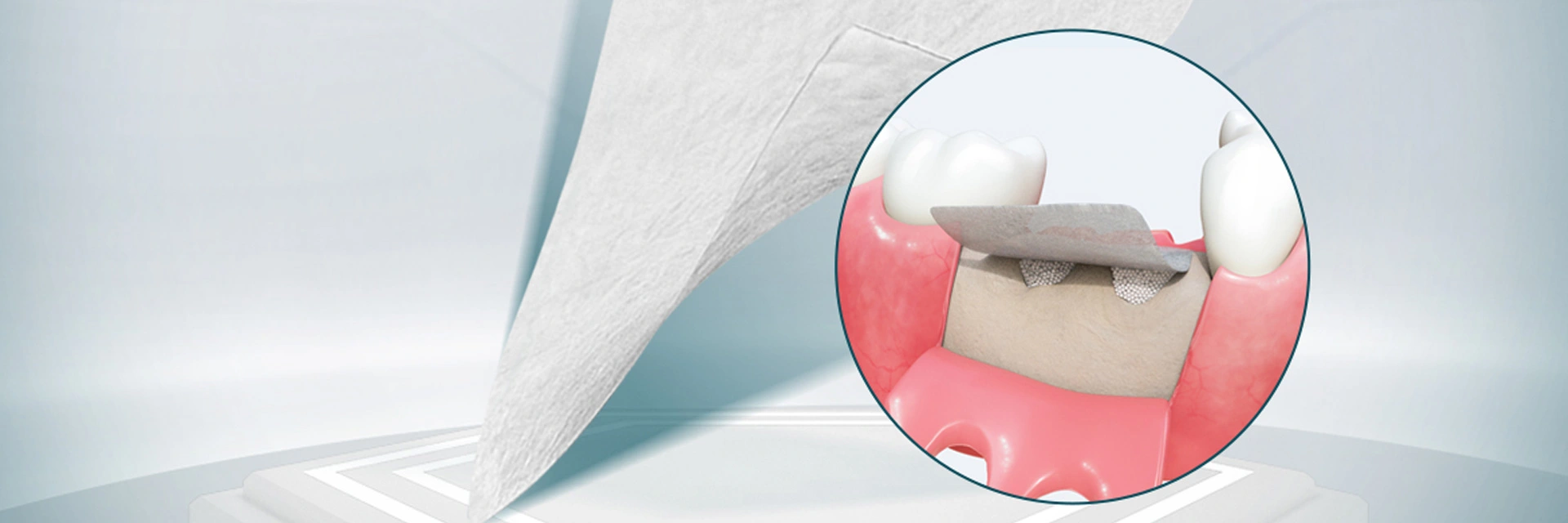 Materiales quirúrgicos dentales