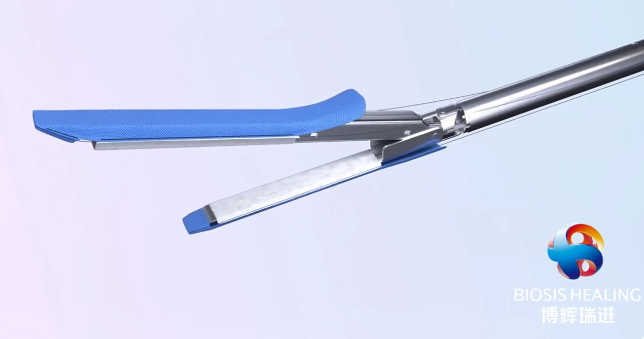 Refuerzo de línea de grapas para la gastrectomía de manga para cirugía bariátrica