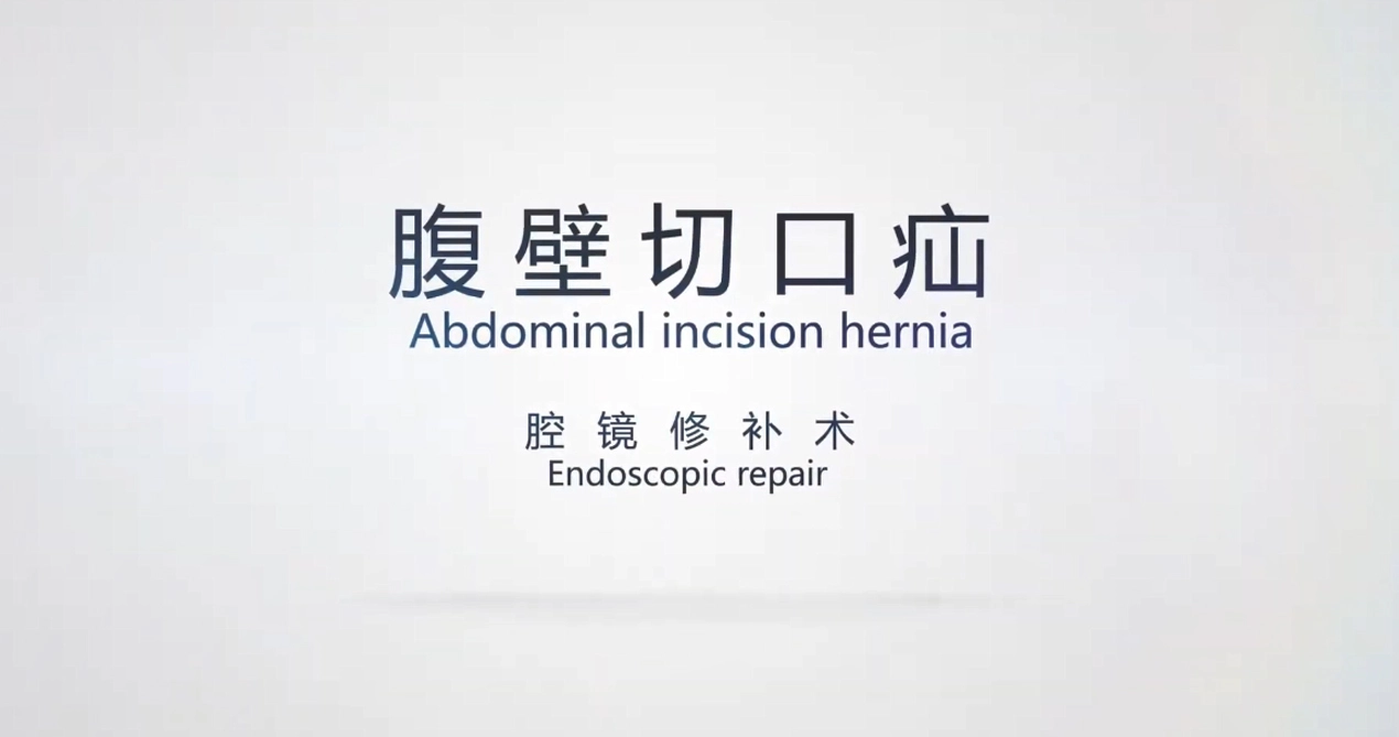 Reparación de hernia de incisión abdominal