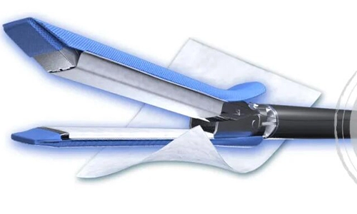 Interpretación del consenso | Consenso de expertos sobre estrategias de manejo para la fuga de aire pulmonar persistente durante la cirugía torácica perioperatoria y los beneficios clínicos de la matriz extracelular de la submucosa del intestino delgado porcino no reticulado (SIS) Mater