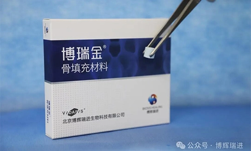 Los productos Vidasis Bone Graft Material obtuvieron oficialmente la certificación, y la familia oral Biosis Healing dio la bienvenida a otro