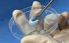 Material de injerto de Hueso